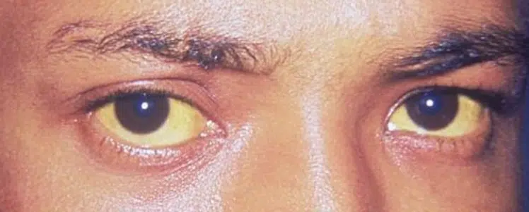Yellow Eyes