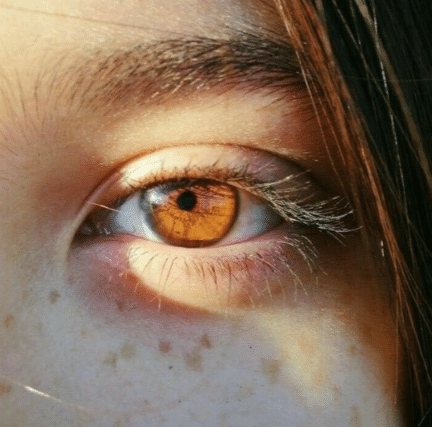 Yellow eyes disease