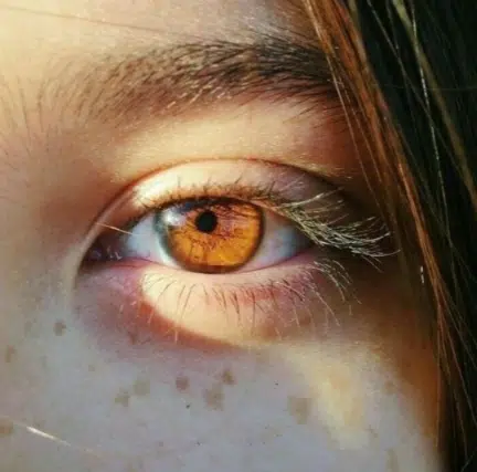Yellow eyes disease