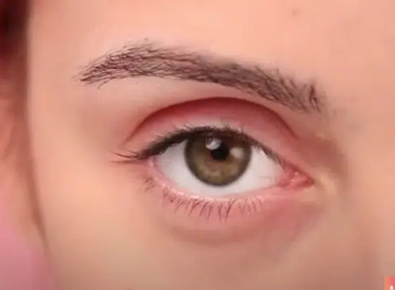 Deep Set Eyes