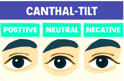 What Is Canthal Tilt?